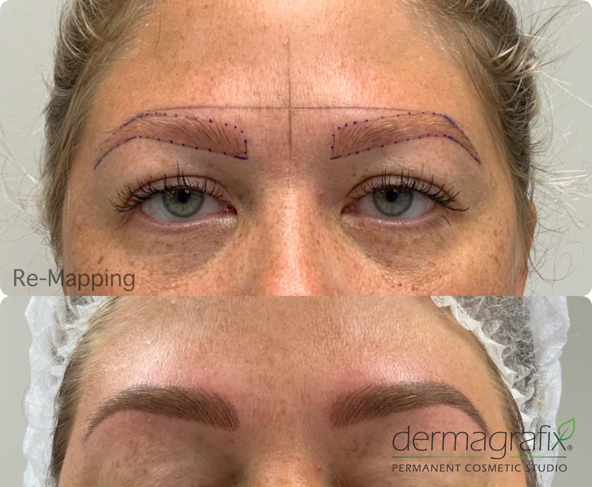 Brow re-mapping above healed Bi-Fusion brows created with machine nano-strokes