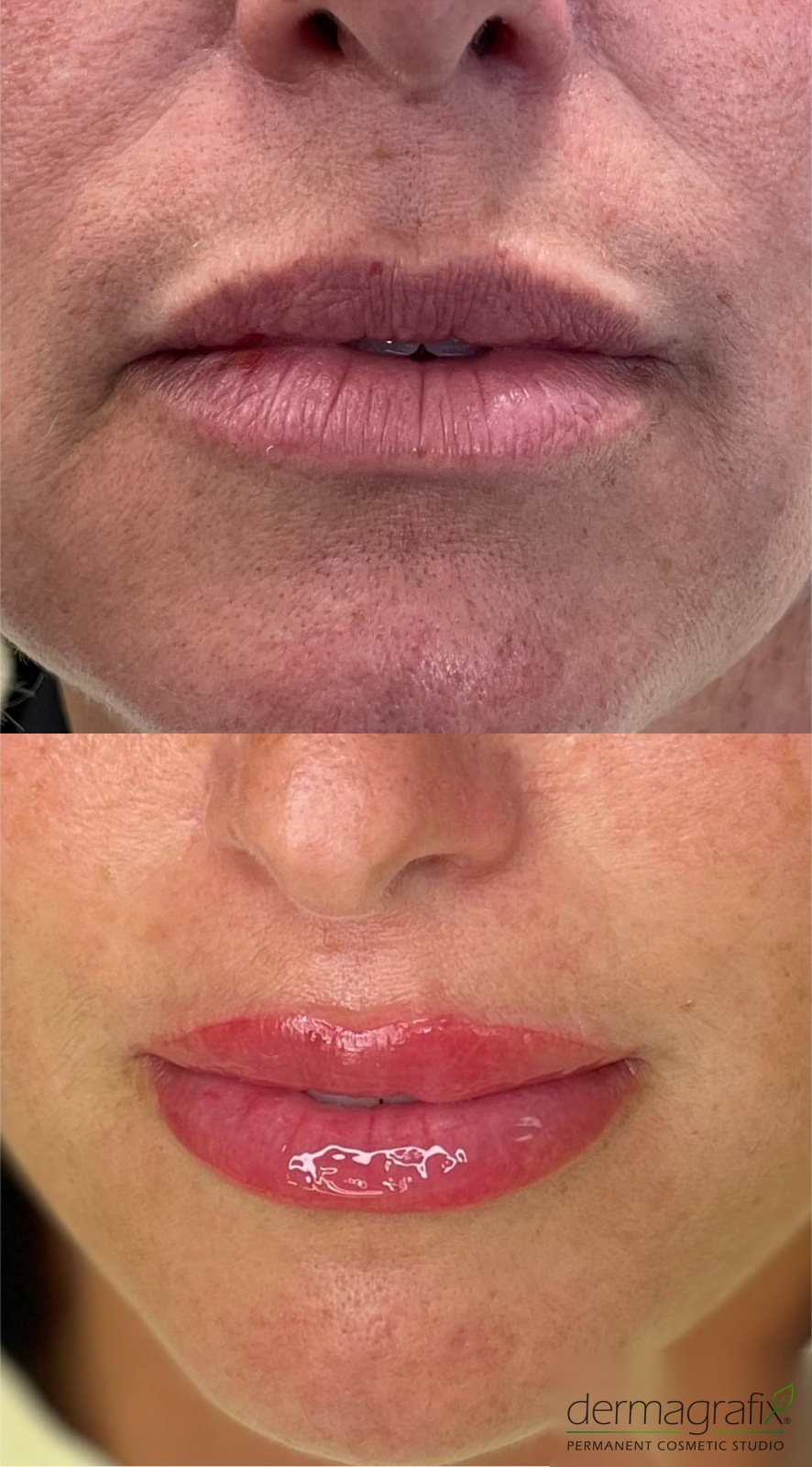 Before and after lip blushing permanent makeup adding warmth, colour, and a defined lip border