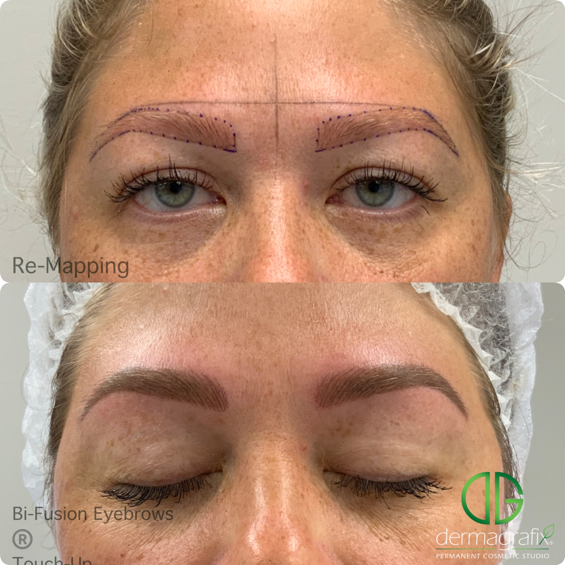 Brow re-mapping above healed Bi-Fusion brows created with machine nano-strokes